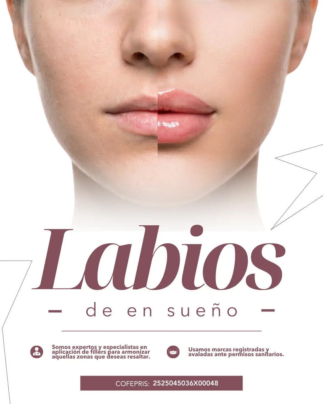 Botox y Rellenos Avanzados